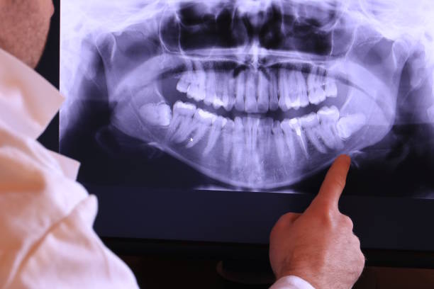 Best Emergency Tooth Extraction in Sand Springs, OK