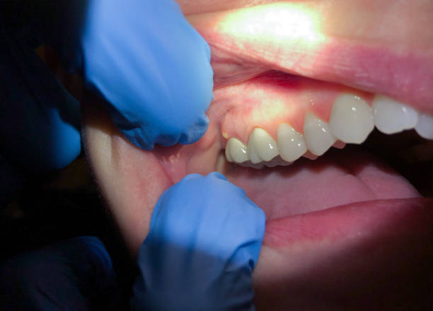 Best Emergency Treatment for Toothache in Sand Springs, OK